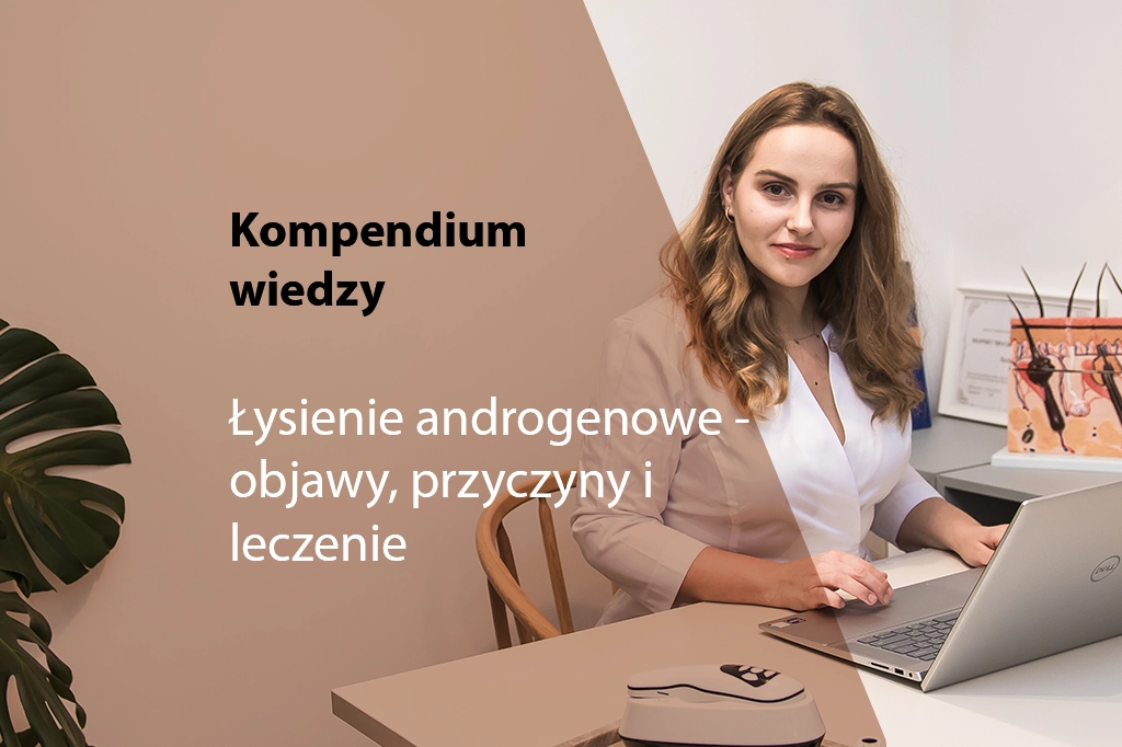 łysienie androgenowe